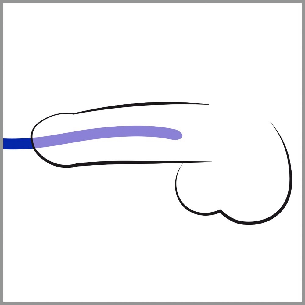 Стимуляторы уретры You2Toys Silicone Dilator Set волнообразной формы, синие, 3 шт.